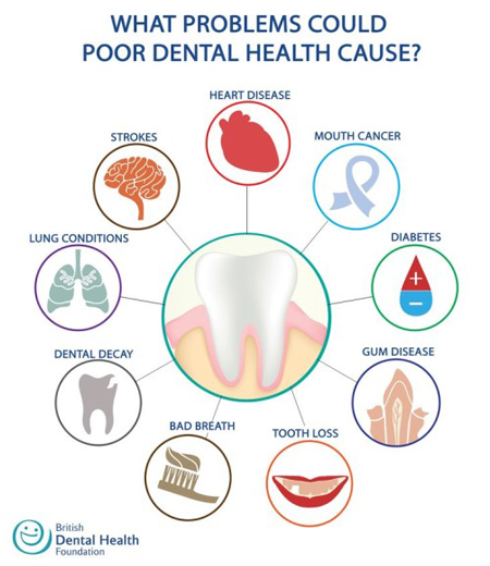 Poor Dental Health Impacts